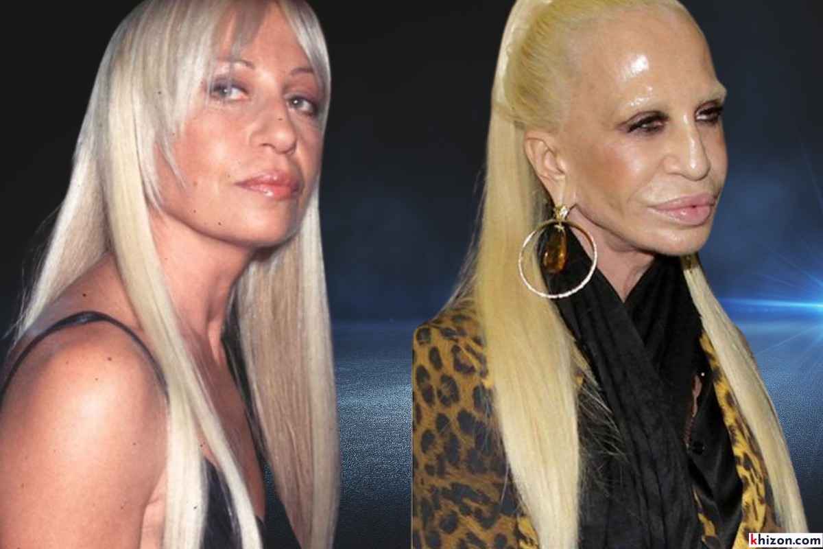 Celebrity Plastic Surgery Trends