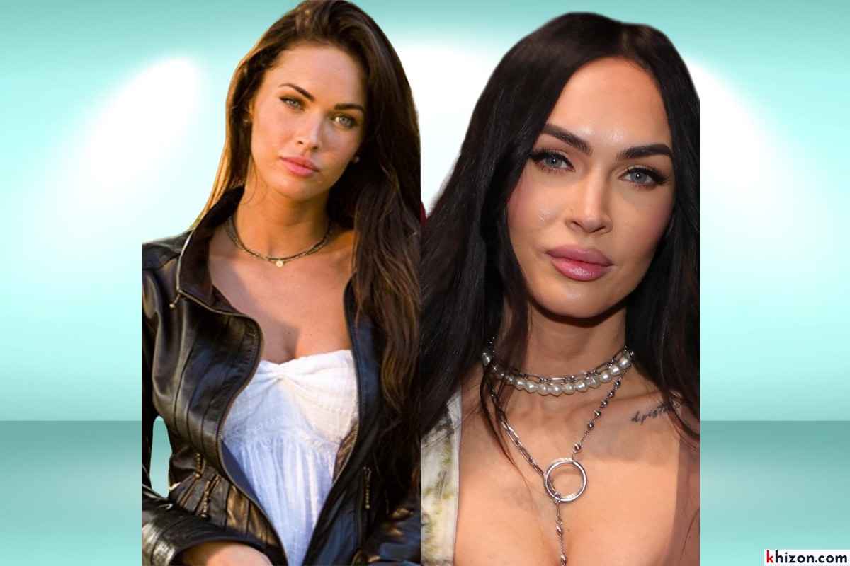 Celebrity Plastic Surgery in Modern