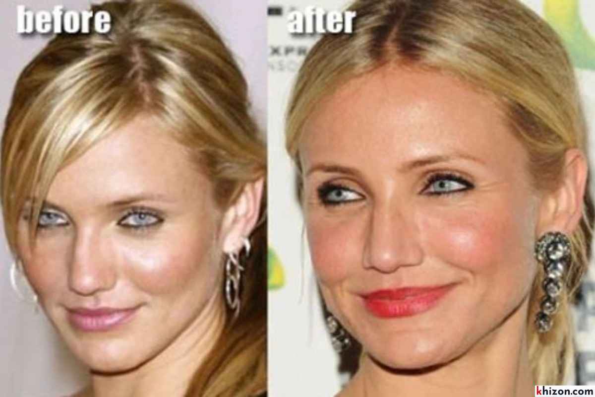 Open About Plastic Surgery
