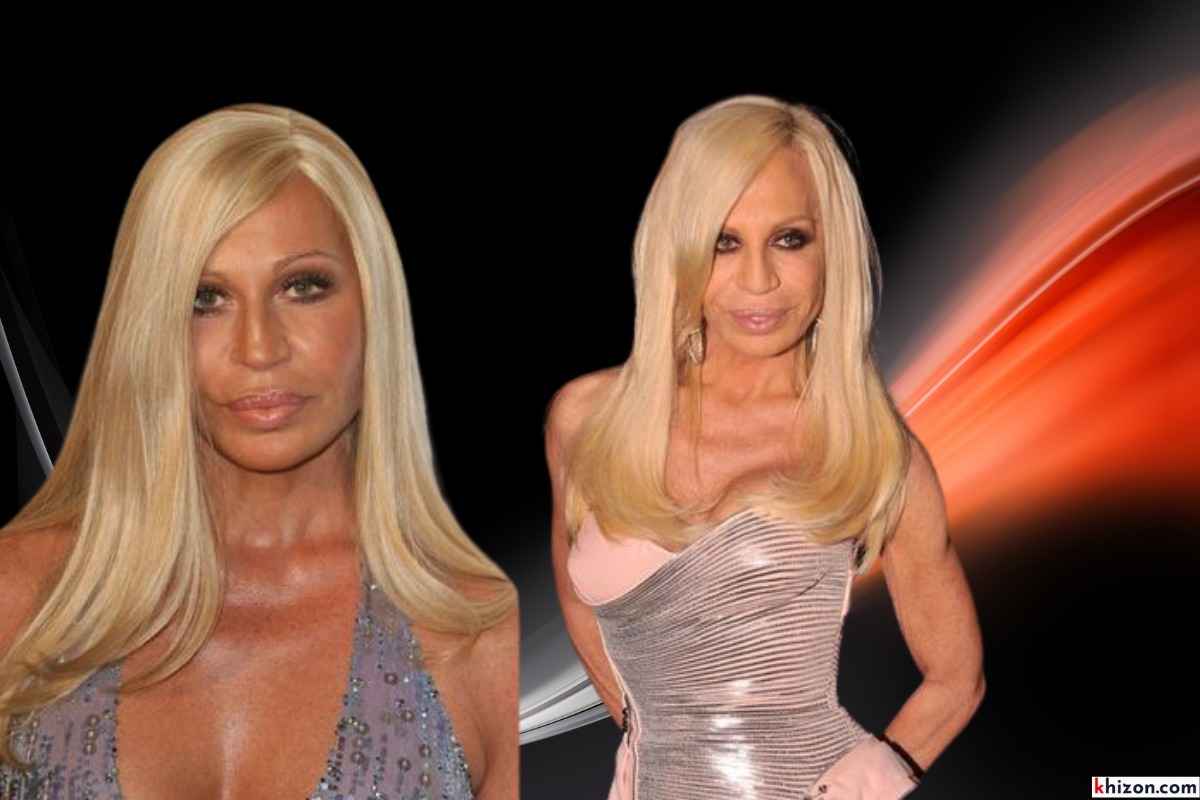 Surgery Transformations